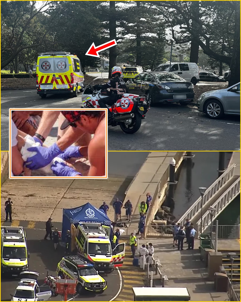 LENT”: Boy Fighting for Life After Shark Atta:ck at Sydney Harbour — CCTV Reveals H0rrifying Moment at Nielsen Park Before He Was Airlifted to Hospital