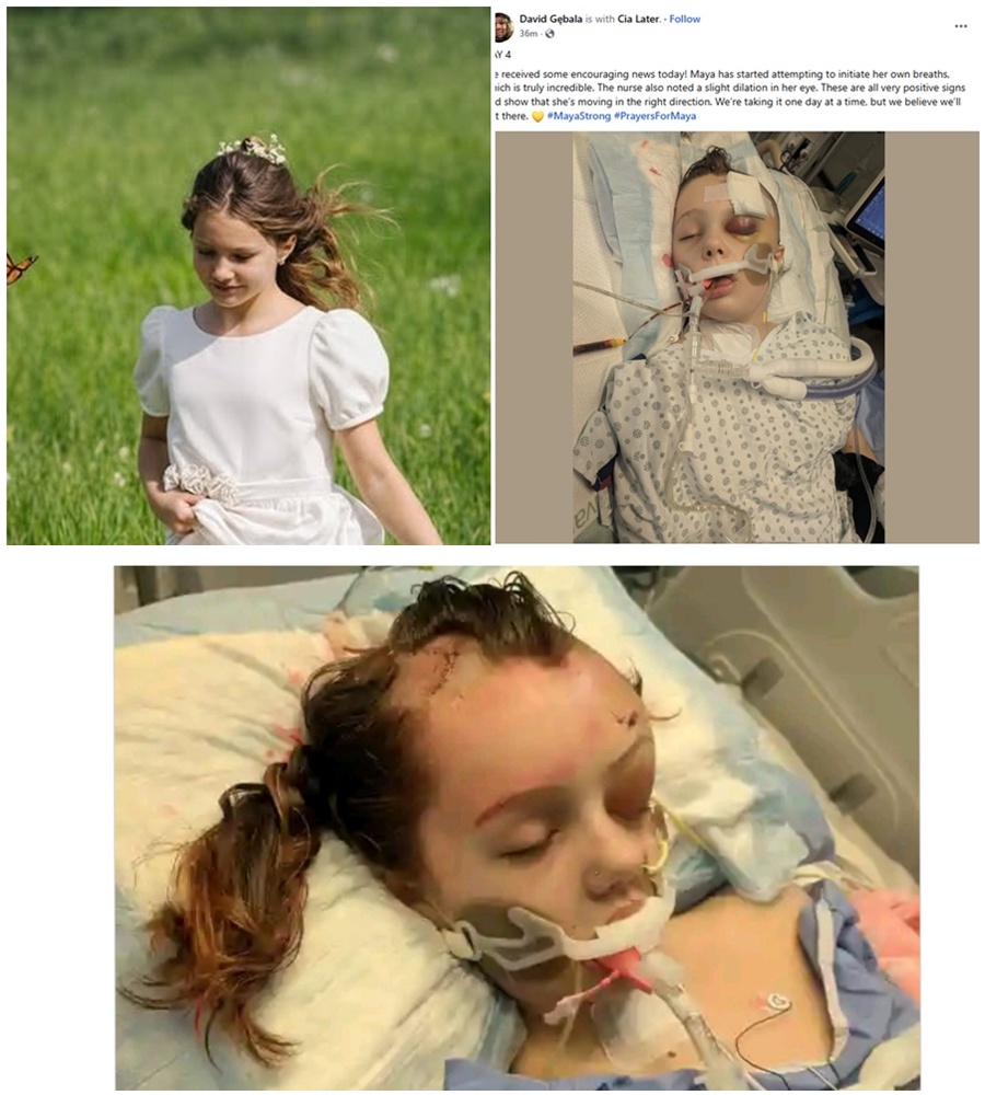 PRAYERS NEEDED IMMEDIATELY. 🚨 Maya Gebala has just come out of a second emergency surgery to save her life. 🌑  After showing “amazing progress” by opening her eye and responding to touch, Maya was struck by a sudden crisis. Fluid flooded her brain, forcing surgeons to place a drain on her right side to relieve the skyrocketing pressure. Her father, David, confirms the surgery was successful, but describes it as another “hurdle” in a battle that seems never-ending. She is stable, but the danger is far from over. 🛡️👣  READ the family’s full message on the surgery results in the comments. 👇