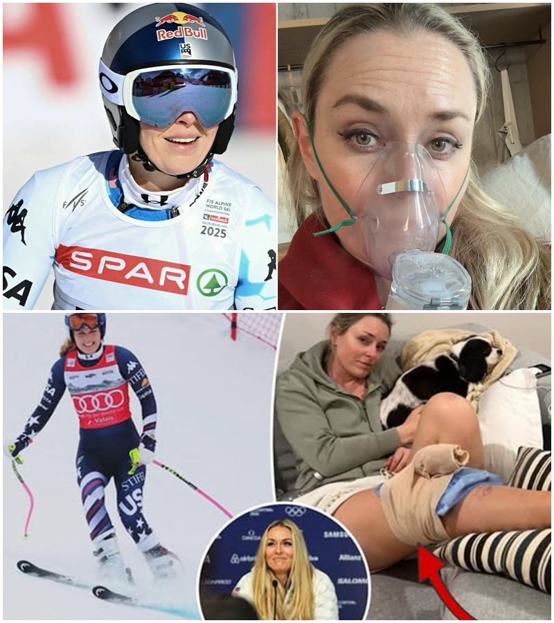 🛑 It wasn’t the knee everyone was watching. Doctors have revealed that Lindsey Vonn’s Olympic exit is due to a severe impact injury separate from her ACL—a diagnosis that has left the skiing world in shock. The exact moment of the damage, captured in a harrowing frame of video, shows a collision so intense it forced an immediate halt to her 2026 plans. Lindsey’s response? Total defiance. She gave it everything, and she isn’t looking back.