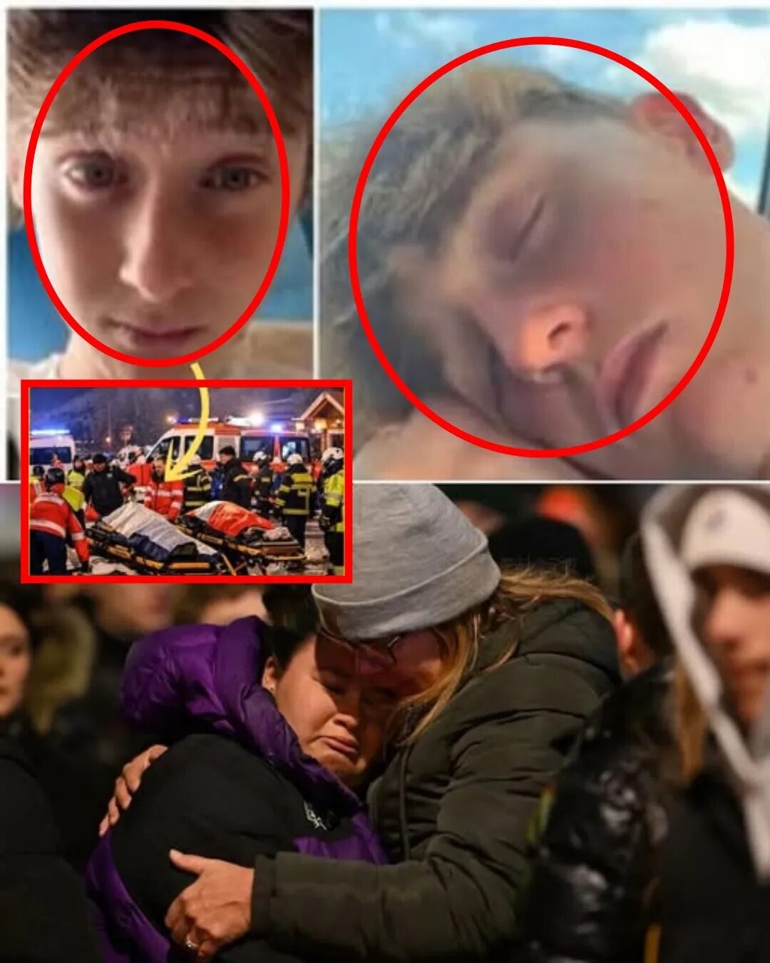 THE FIRST BREATH: GIUSEPPE’S BRAVE FIGHT 🕊️🫁 “A MOMENT OF PURE HOPE. Giuseppe, one of the youngest survivors of the Crans-Montana fire, has just taken his first independent breaths. After days of clinging to life on a ventilator, doctors took the high-stakes step of removing his breathing tube. 🏥✨ The room fell into a heavy silence as everyone watched—then, it happened. His breaths were weak and uneven, but they were his own. It is a monumental step forward, yet the warning remains: lung damage from such thick smoke is a treacherous path, and full recovery could take months. 📉