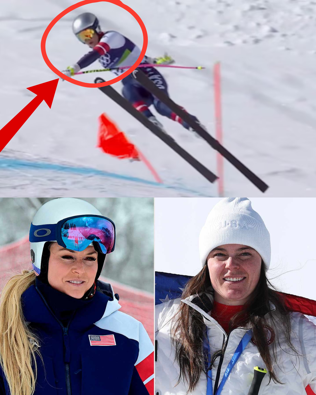 ❤️ Lindsey Vonn is currently in intensive care after a crash that did more than just break her leg—it shook the Winter Games to their core. Analysts are now pointing to a single frame of footage that reveals the terrifying ‘hidden factor’ that caused the impact. It wasn’t an error in judgment; it was a split-second mechanical catastrophe. Our thoughts are with Lindsey as she faces her toughest recovery yet.