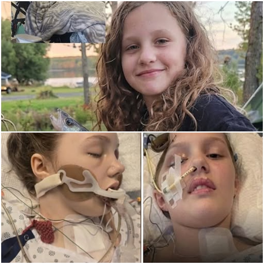 🔥 BREAKING: 12-Year-Old Maya Gebala Back in Critical Condition After Surgical Complications What was meant to be a major step forward has taken a serious turn. After surviving the tragic shooting in Tumbler Ridge, Maya Gebala (12) underwent a complex procedure to repair her skull — a surgery doctors hoped would move her closer to recovery. But during the operation, unexpected complications forced the medical team to stop. Sources say her body is struggling to respond to the implant, creating new risks that doctors are now urgently trying to stabilize. 💔 Instead of leaving intensive care, Maya has been placed back under critical monitoring. Her family is once again facing an uncertain path, as specialists reassess what can be done next. 👉 What exactly went wrong during the procedure? 👉 And what options remain for her recovery? Full story in the comments 👇