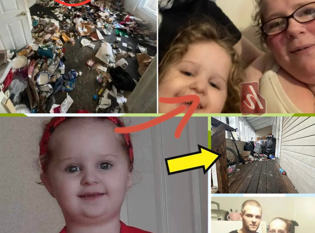  A 3-Year-Old Girl Died With Black Rotting Teeth …