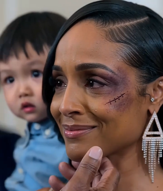 A birthday celebration turned into complete chaos when a father noticed the injuries on his daughter’s face…